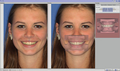 OnyxCeph3TM Module Smile 3D