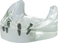 
Demo model in acrylic, tioLogic® TWINFIT, mandible, edentulous, 4 implants, without prosthetics
