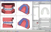 OnyxCeph³™ module Waefer Creation