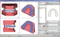 OnyxCeph³™ Modul Waefer Creation