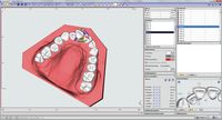 OnyxCeph³™ Modul Aligner 3D