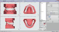 OnyxCeph³™ module Retainer 3D
