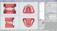 OnyxCeph³™ Modul Retainer 3D