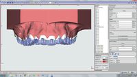 OnyxCeph³™ module Bonding Trays 3D