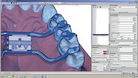 OnyxCeph³™ Modul Ortho Apps 3D 