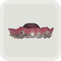 TRIOS Orthodontic Planner app