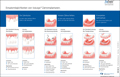 Gesprächshilfe Funktionsprinzip tioLogic® Implantate Patienteninformation (laminiert), deutsch